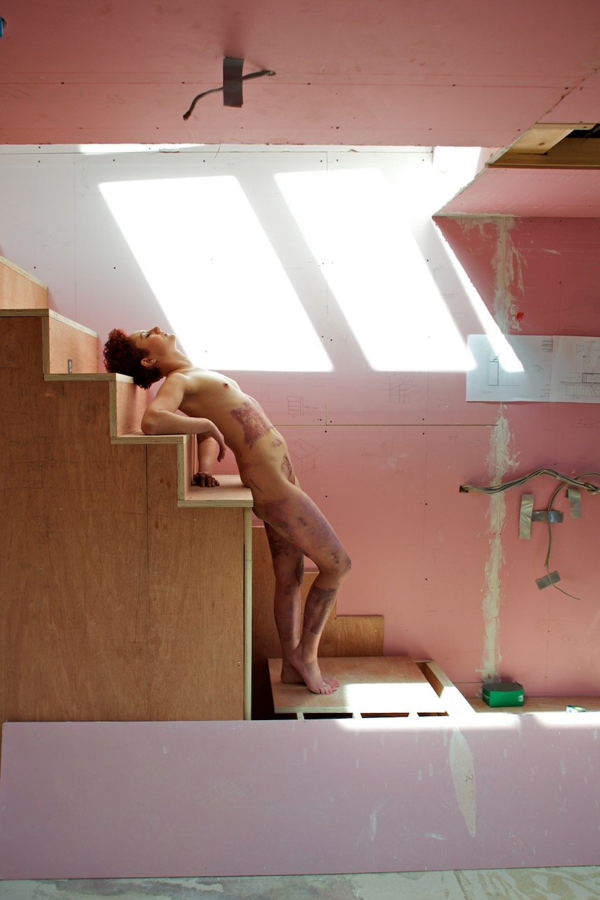 recovery - 5 of 15.jpeg