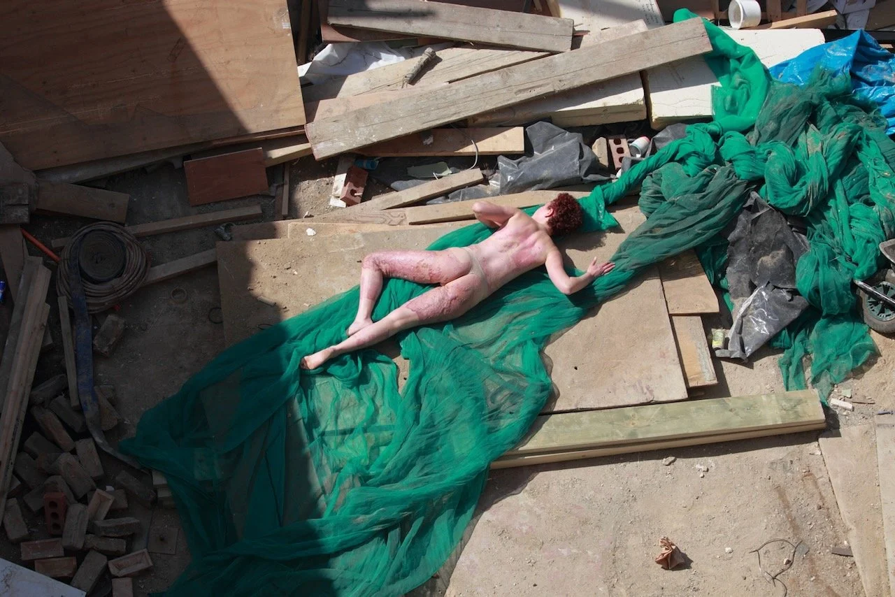 recovery - 1 of 15.jpeg