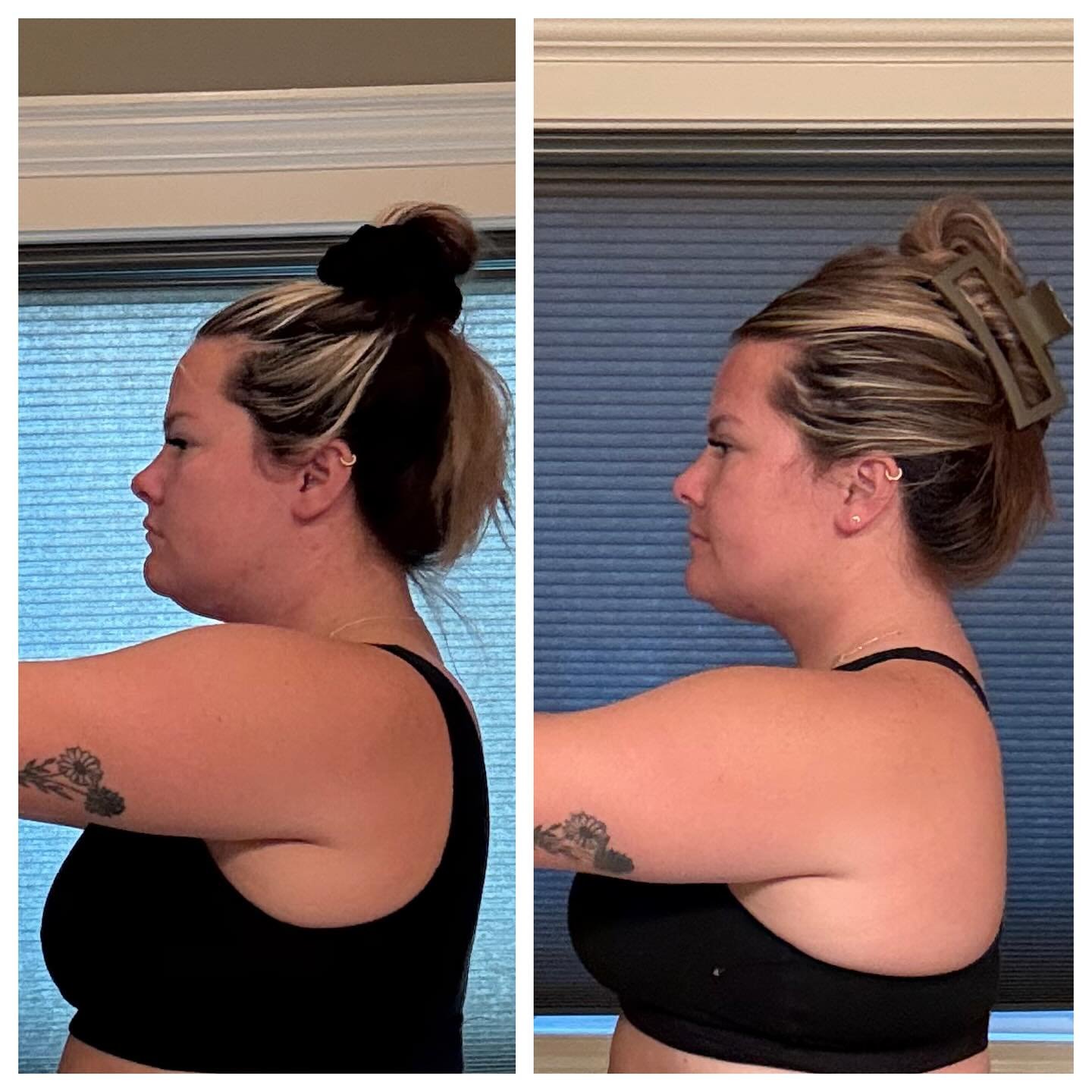 This is your reminder that you do NOT have to live with
low energy ⚡️ | cravings 🍫 | anxiety 😩 | bloating 💨 | inflammation 🔥 | or water retention 💧

Just 6 weeks on peptides and you can see the difference &mdash; the swelling in my face has redu