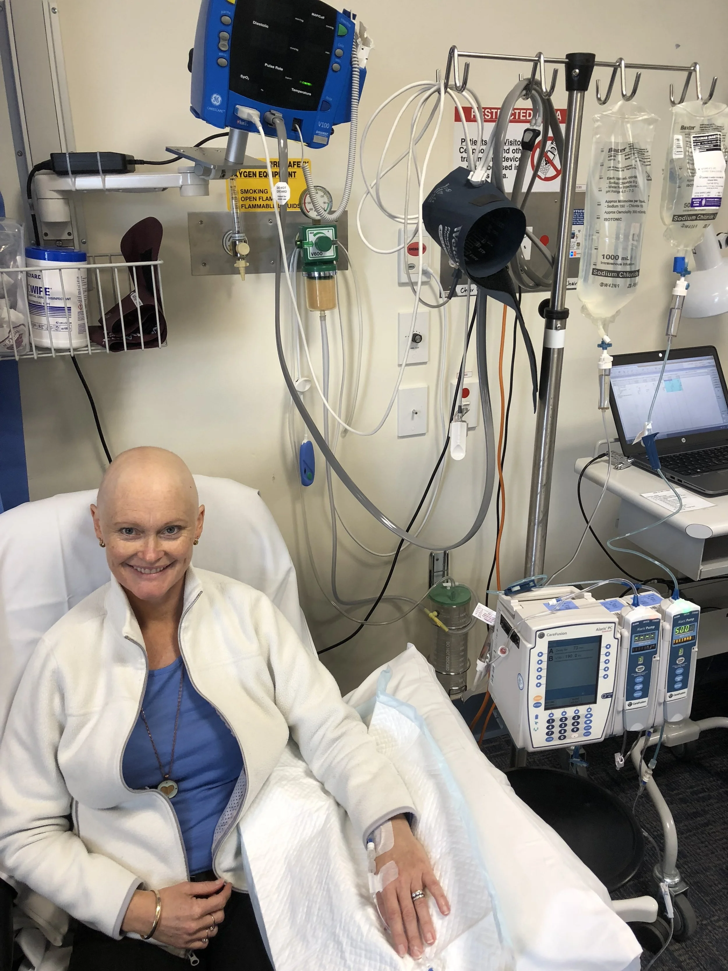 Vicki, a women with no hair, having chemotherapy for Lymphatic Cancer sitting in hospital with chemo drips