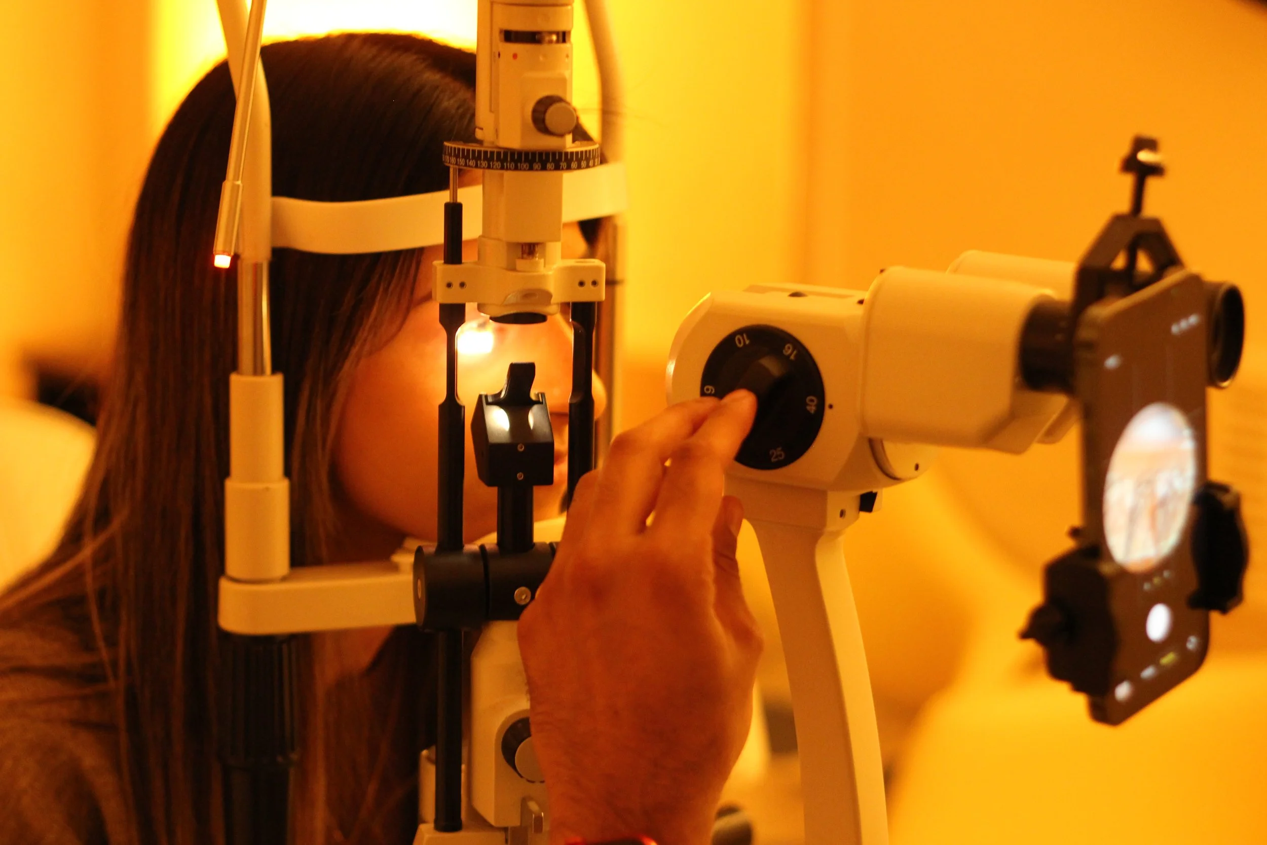 Dry eye examination using slit lamp equipment at EyeDRATE Clinic