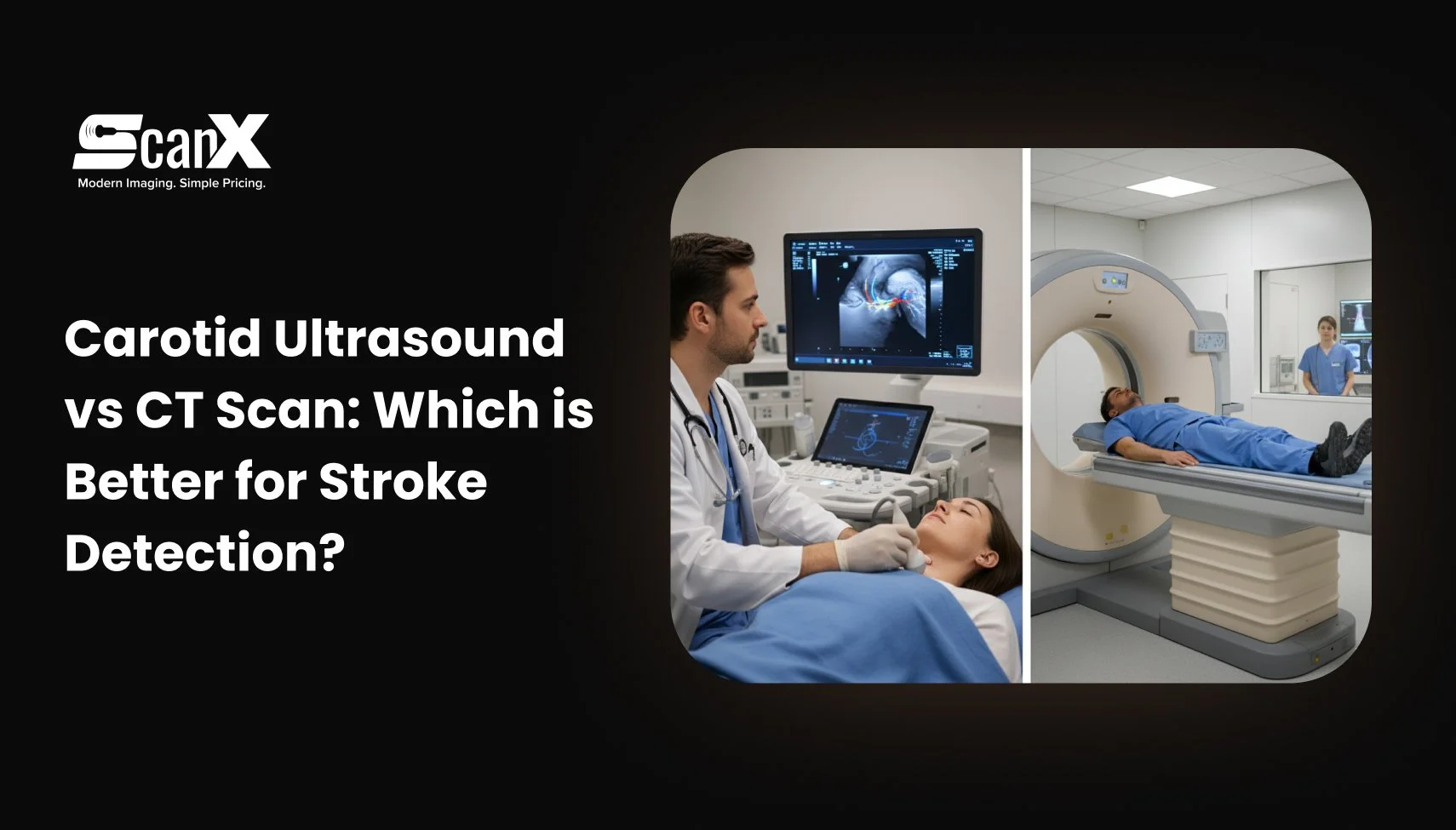 Carotid Ultrasound vs CT Scan: Which is Better for Stroke Detection?