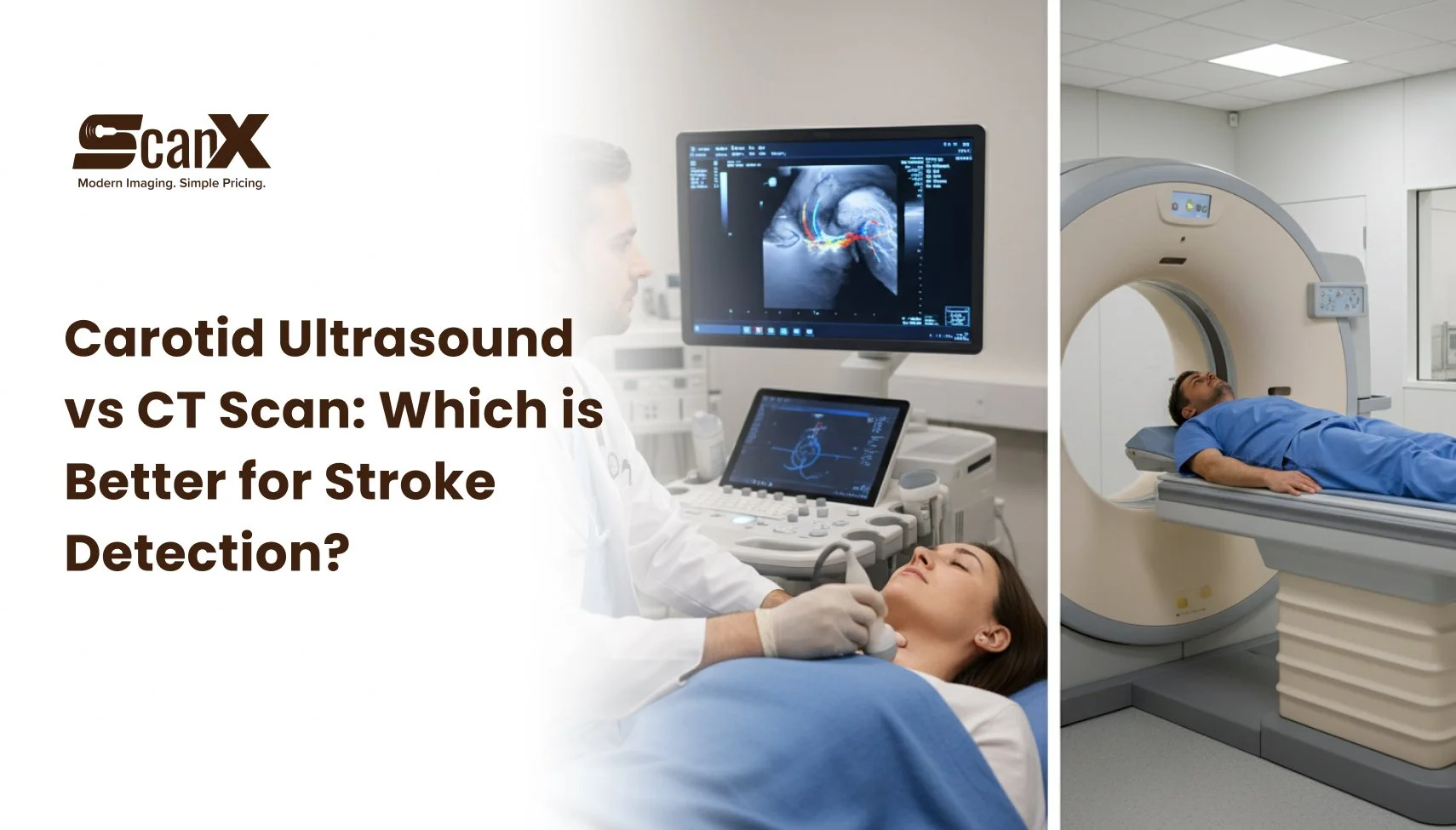 Carotid Ultrasound vs CT Scan: Which is Better for Stroke Detection ...