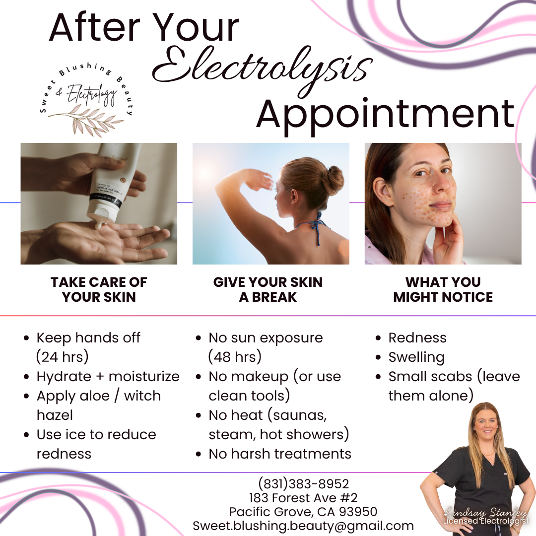 A flyer providing tips for after electrolysis skin care, featuring images of a person applying lotion, a woman with her back to the camera, and a woman with acne. It lists steps to take care of skin, give skin a break, and notice signs of skin issues, along with contact information for a licensed electrologist.