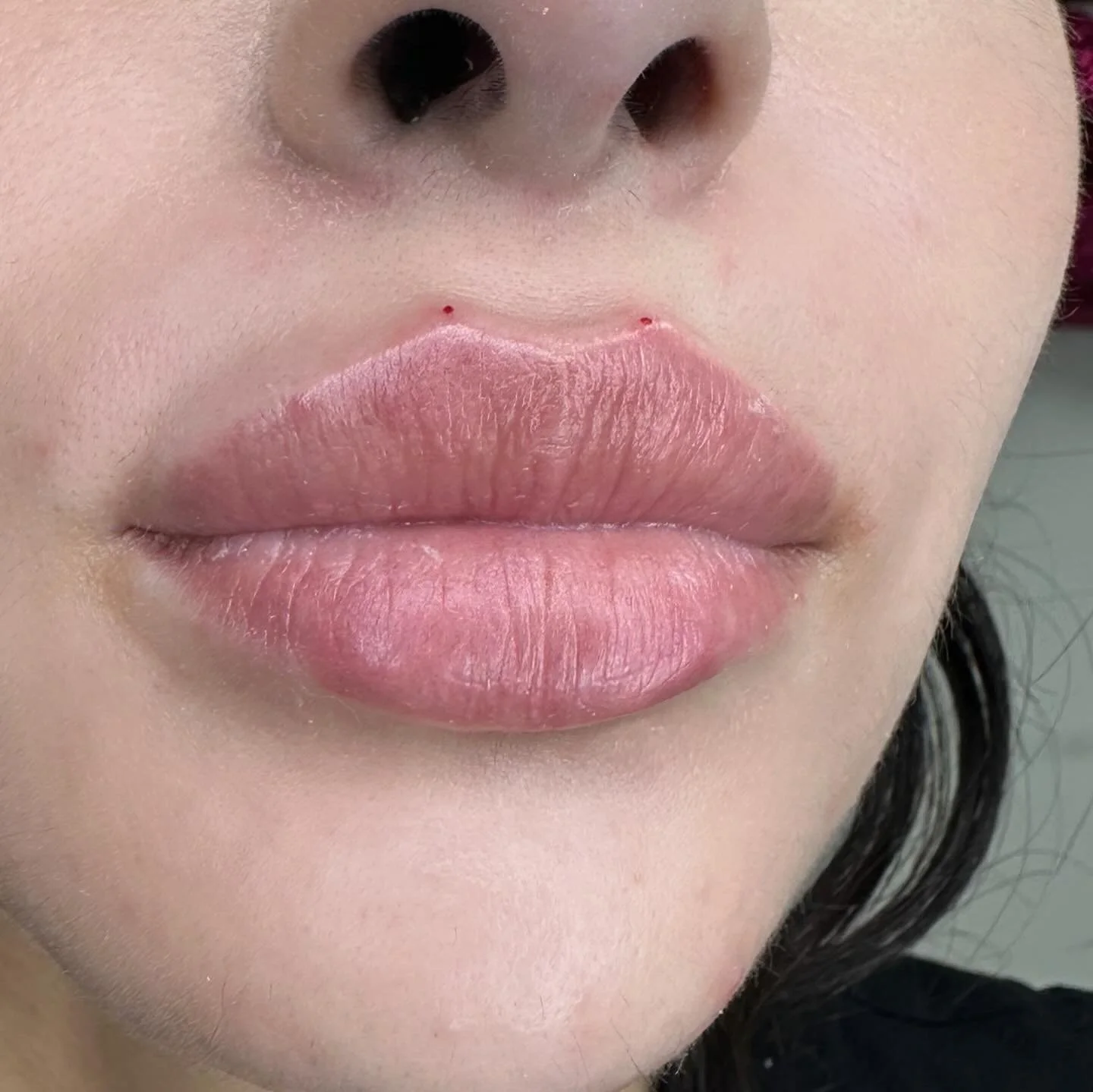 Lip injection💉💉💉
For information DM!