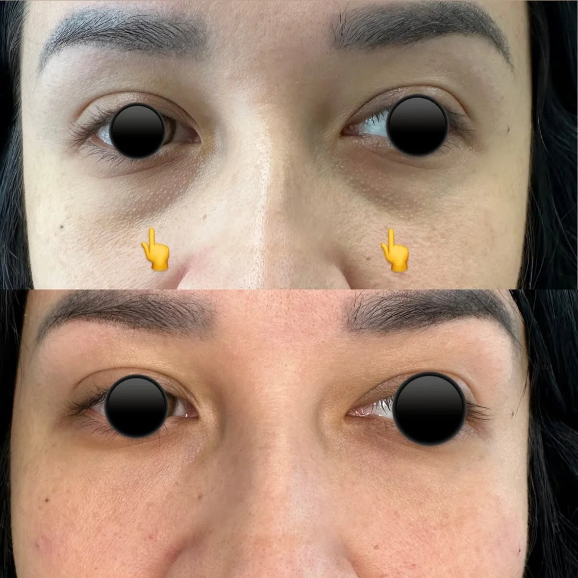 Under eye correction.!