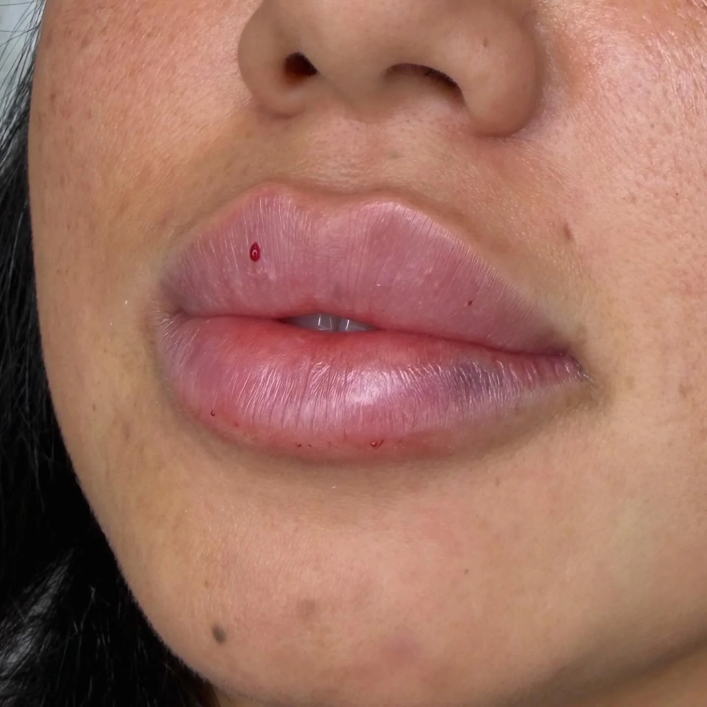 Lips🤍
For more information DM💌
Or call us 📞7473086416