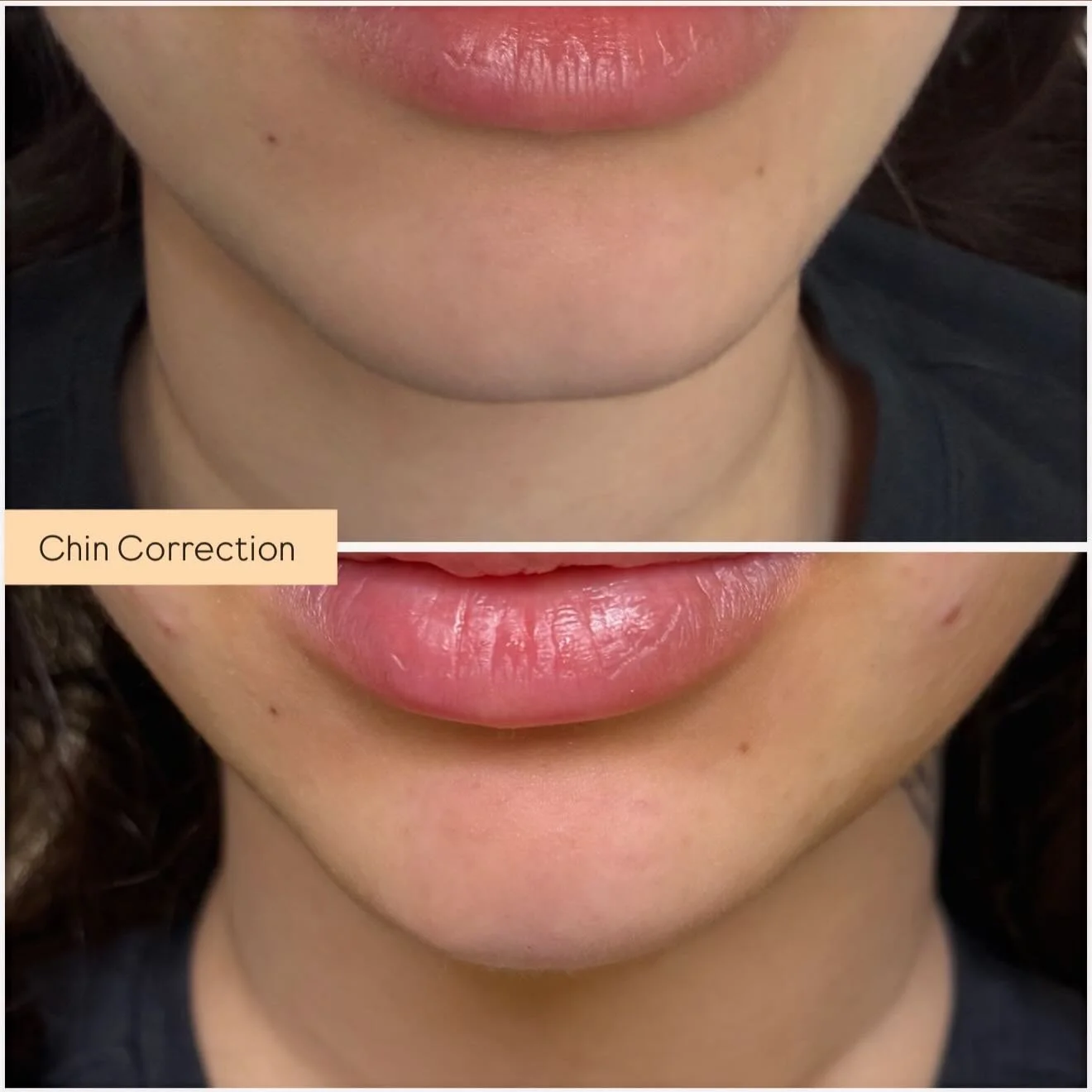 For appointment 📞7473086416
Or SkinnLoft.com