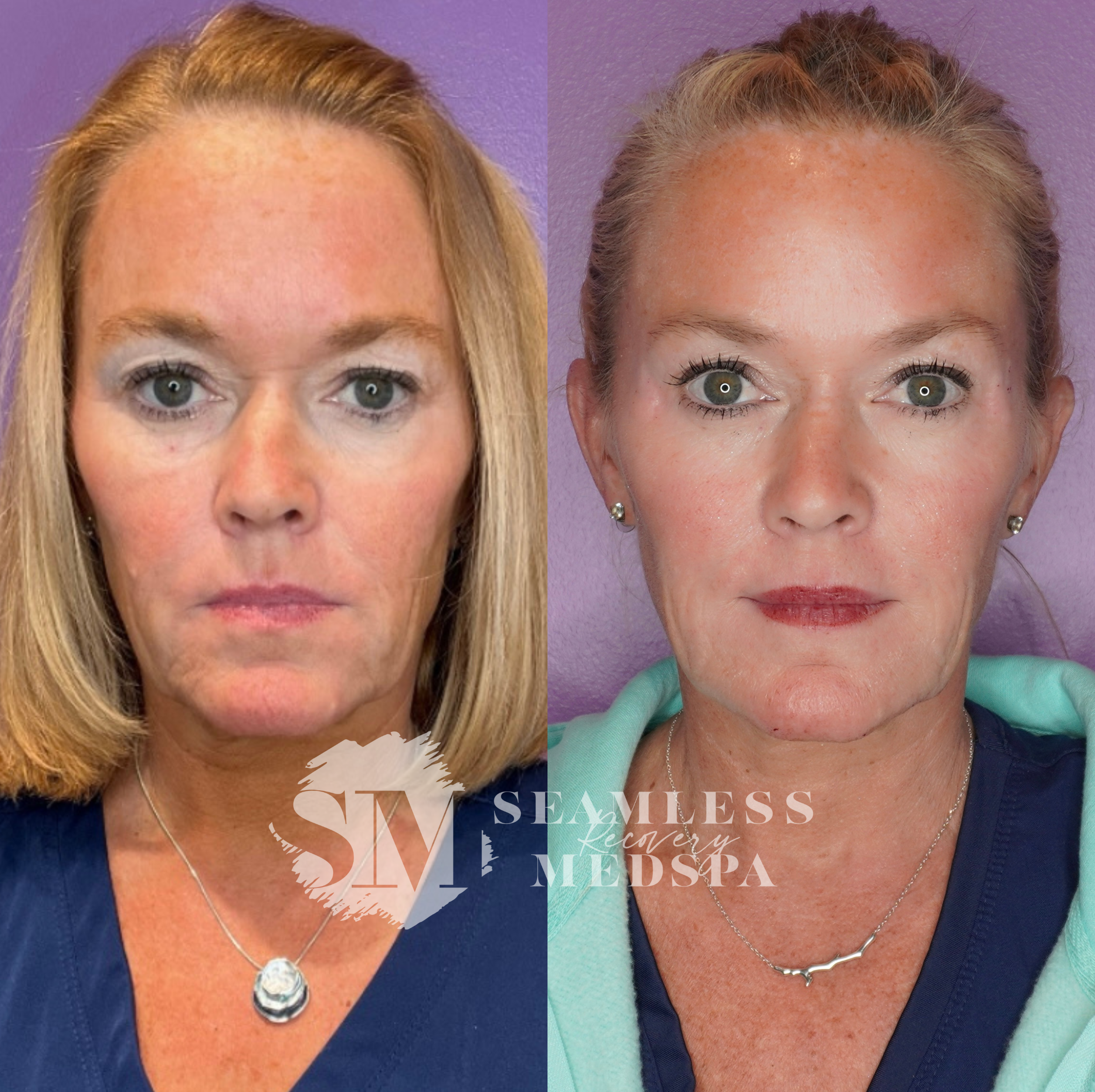 Untitled Design - 1 (2).png