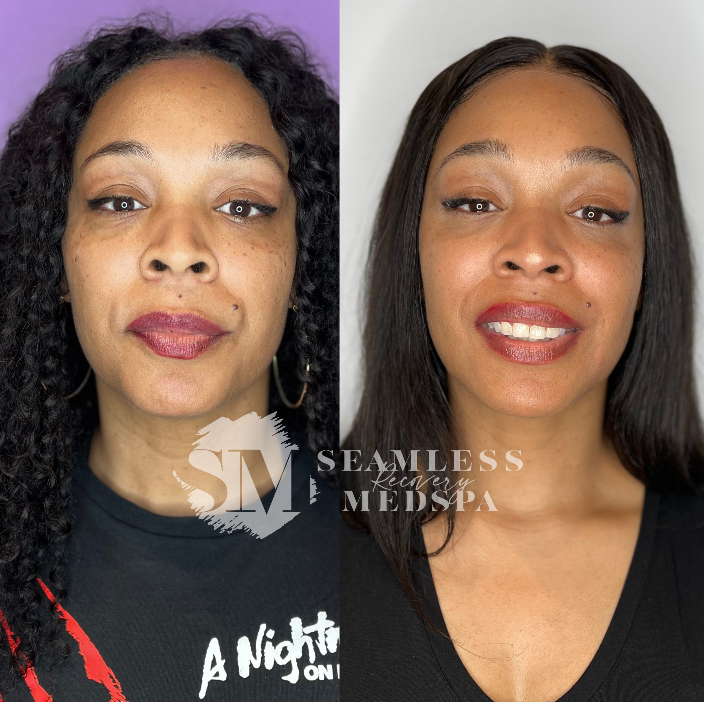 Untitled Design - 1 (1).png