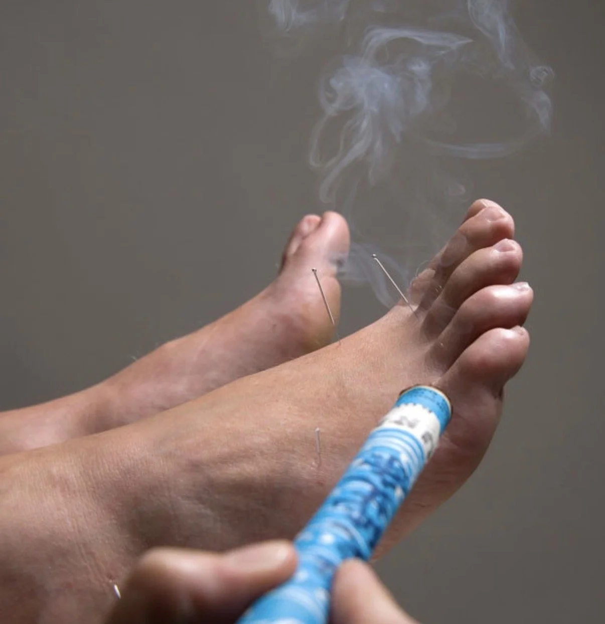 Acupuncture for Breech Baby: How Moxibustion Can Help