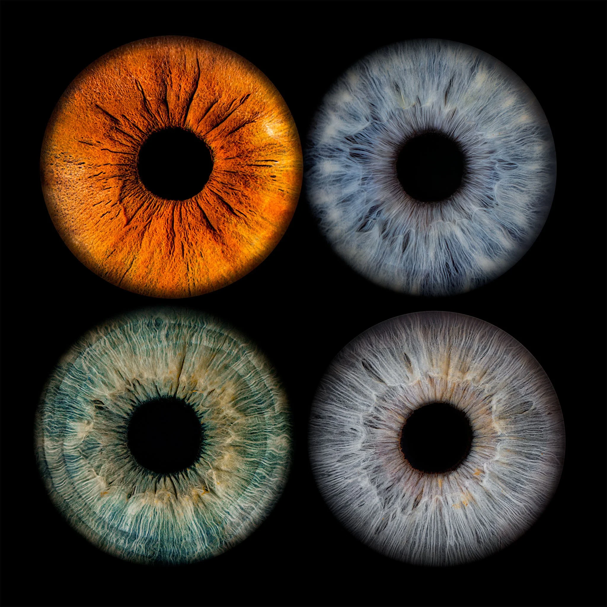 Brown, Blue, Hazel, or Green? The Trick of Light Behind Your Iris