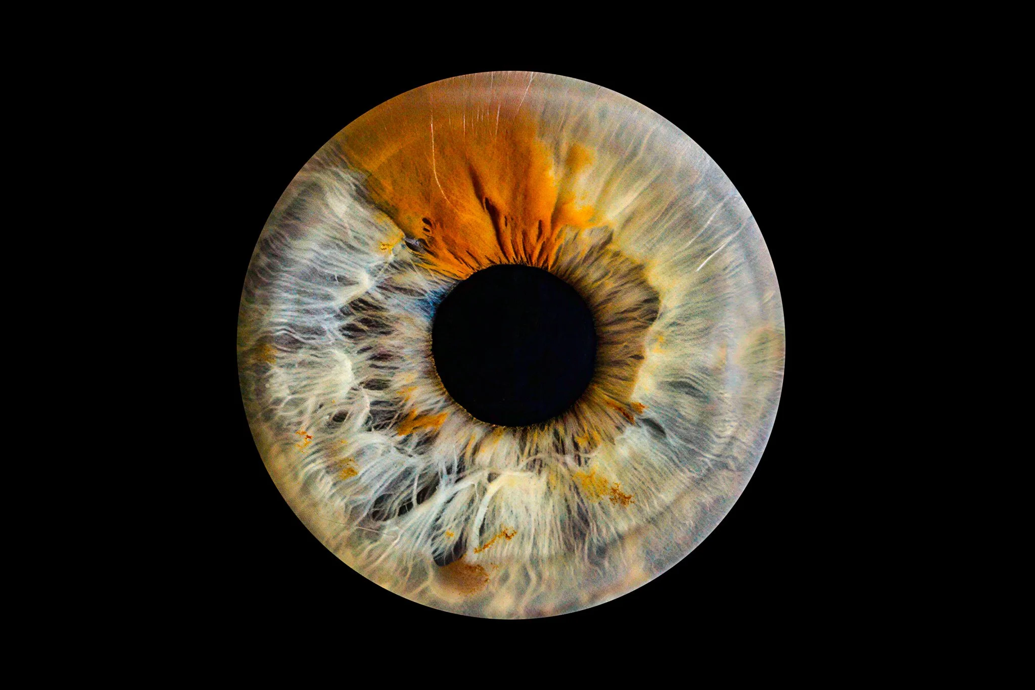 Heterochromia-blue-green-brown-iris.jpg