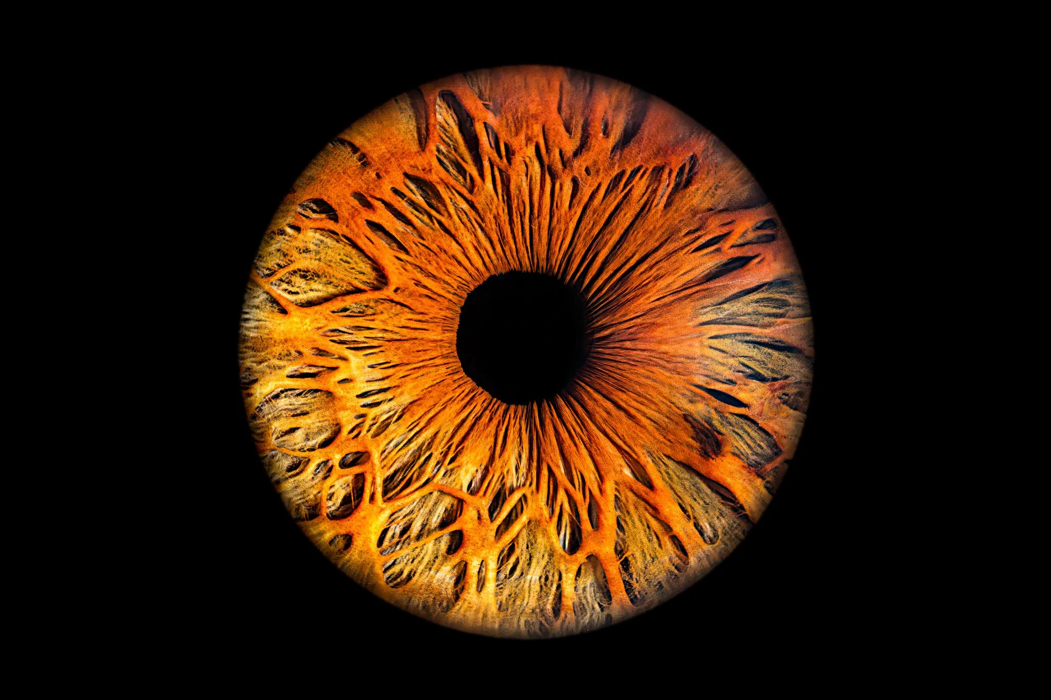 Brown-iris-with-deep-crypts-furrows.jpg