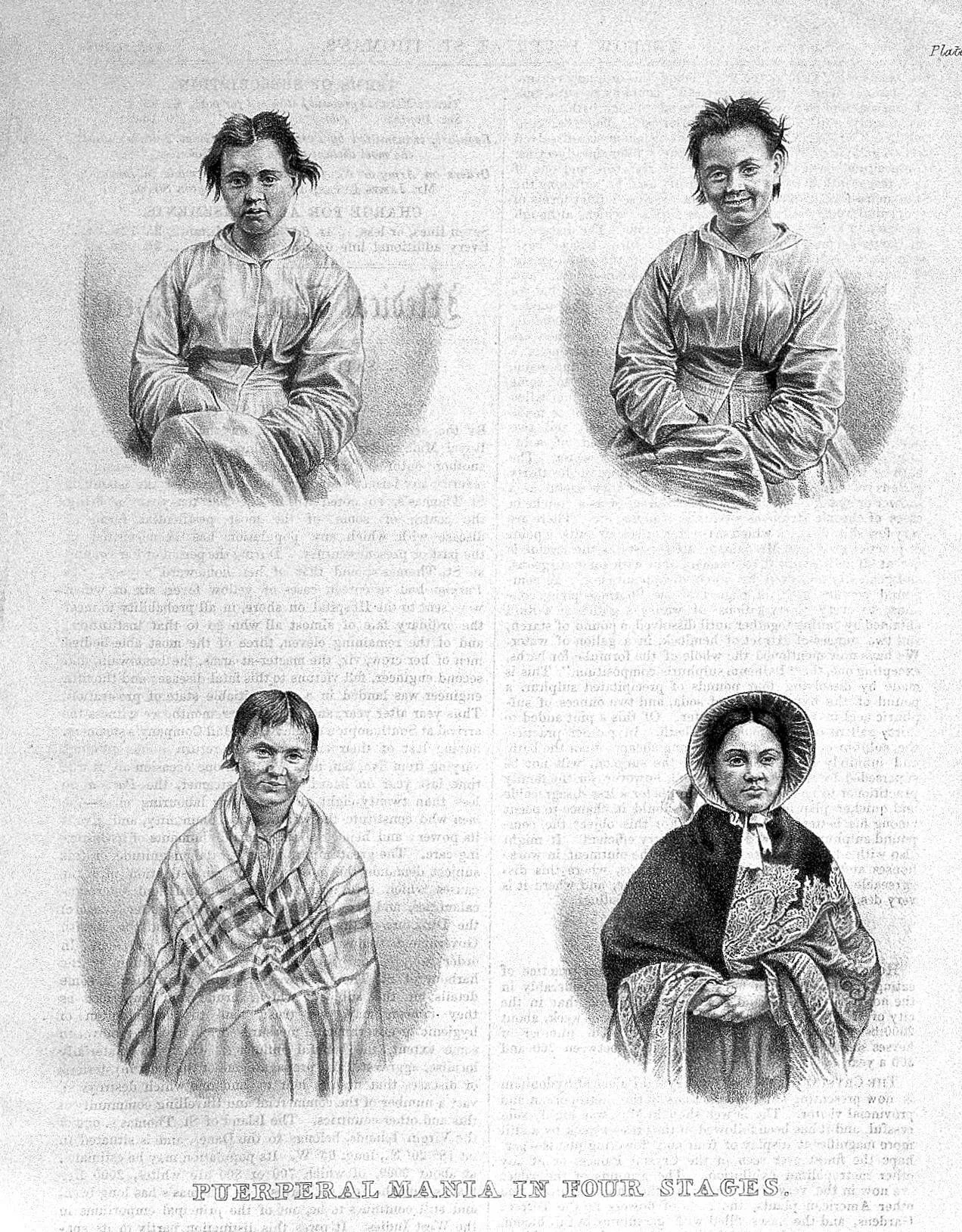 "Puerperal Mania in Four Stages." Medical Times & Gazette, 1858. Courtesy of the Wellcome Collection.