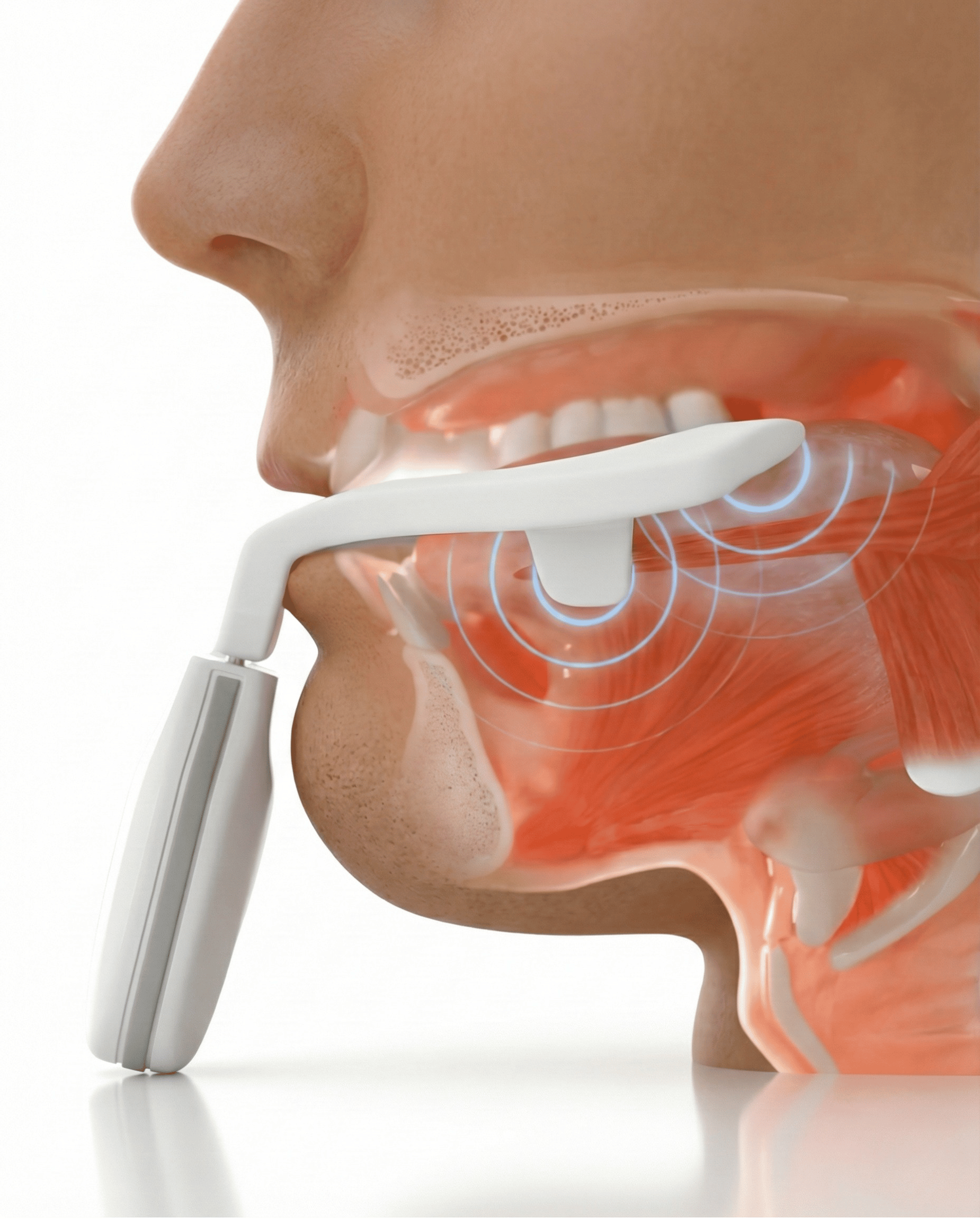 eXciteOSA Daytime Therapy Device  (2).png