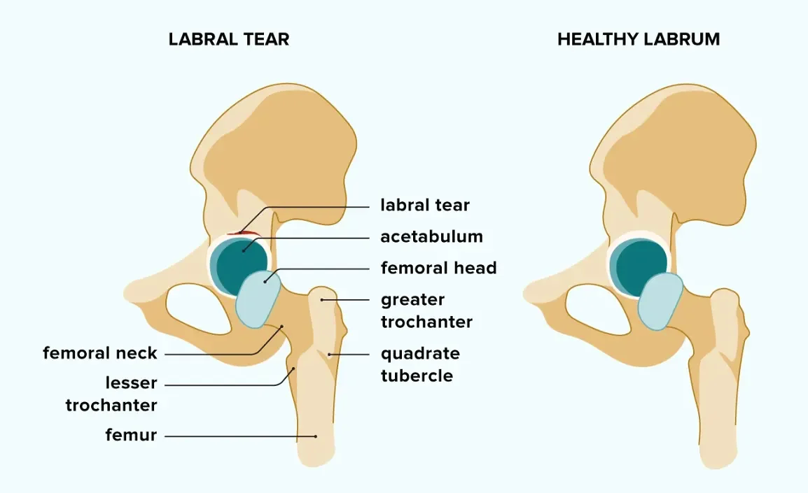Medical Illustration by Bailey Mariner