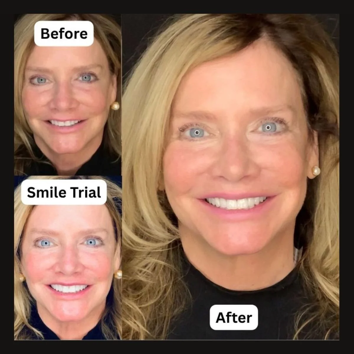  Smile Makeover 