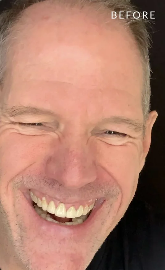 before-man.jpg