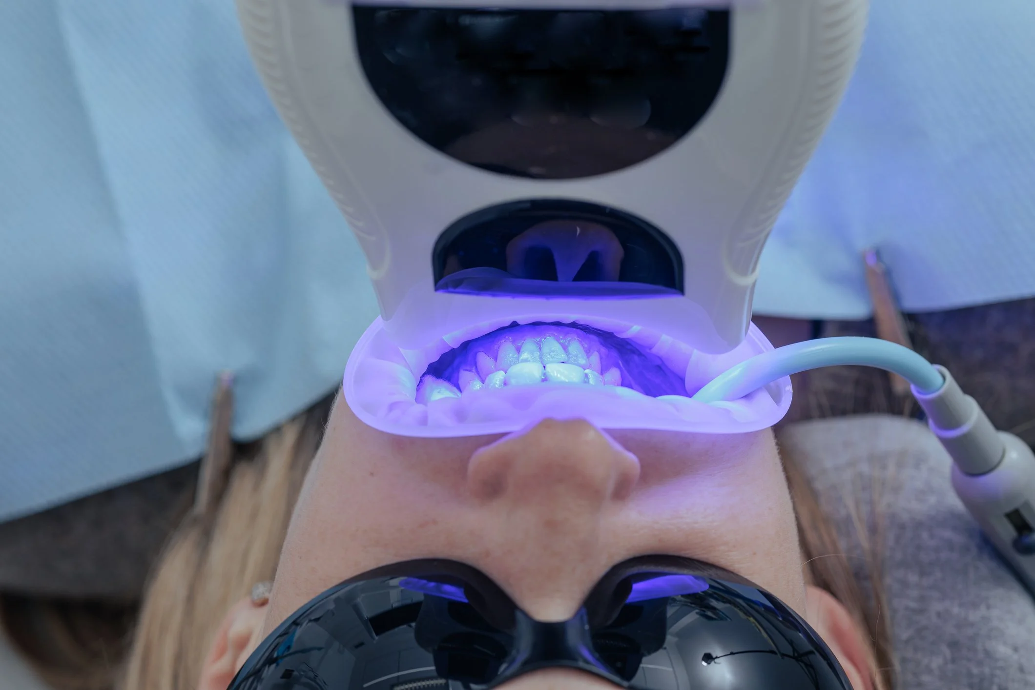 What Are Advanced Cosmetic Dental Procedures?