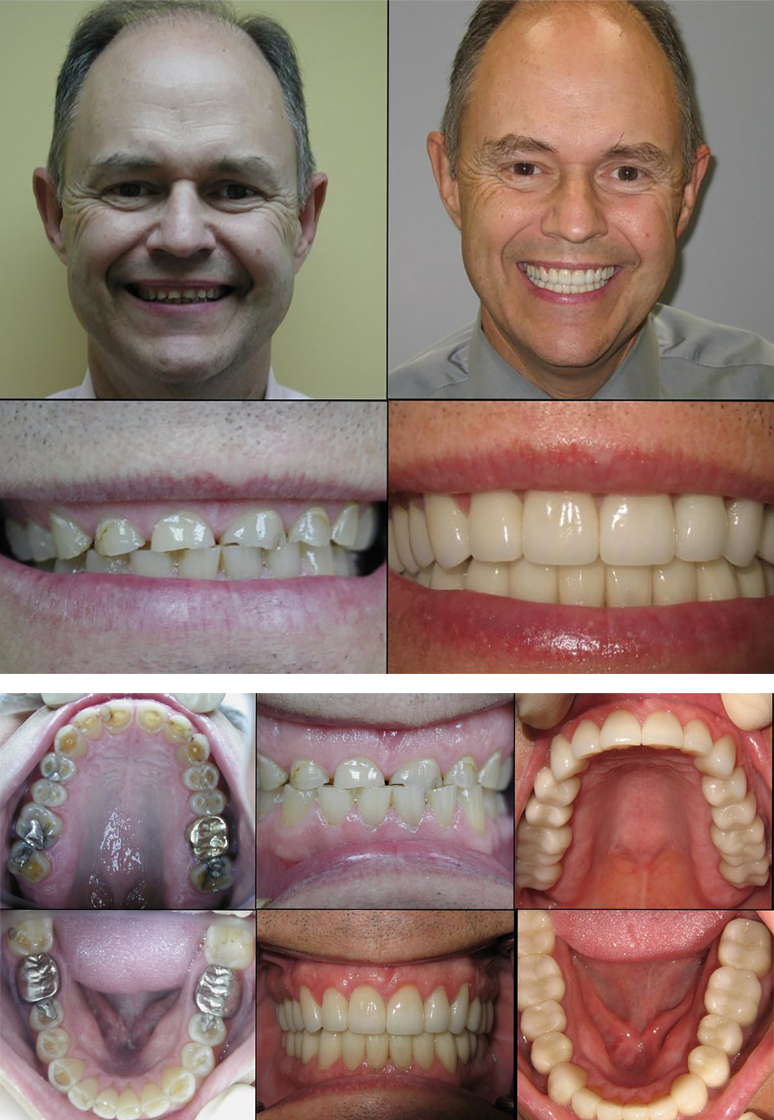 Smile-Rejuvenation-collage-1.png