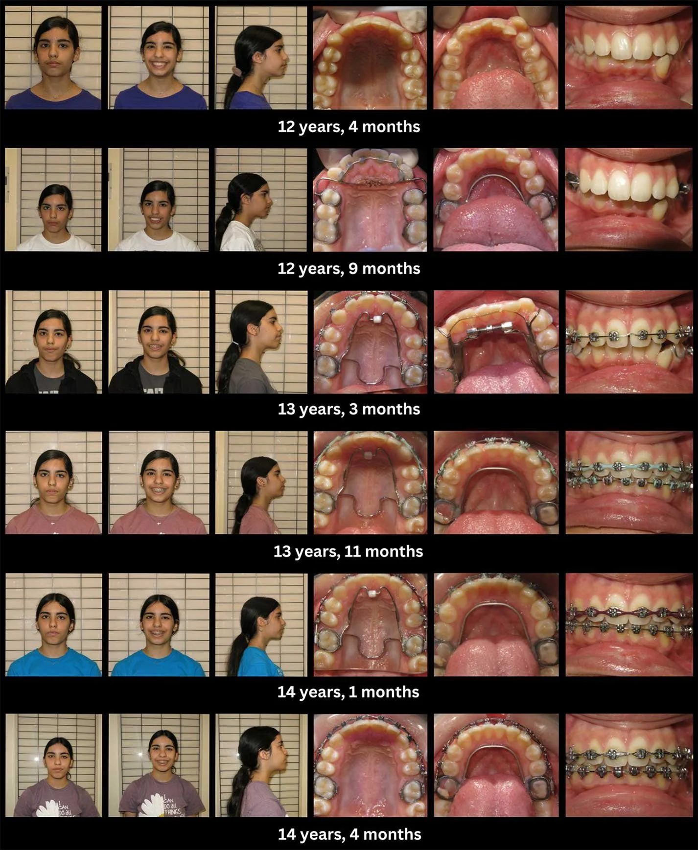 functional-orthodontics-6.jpg
