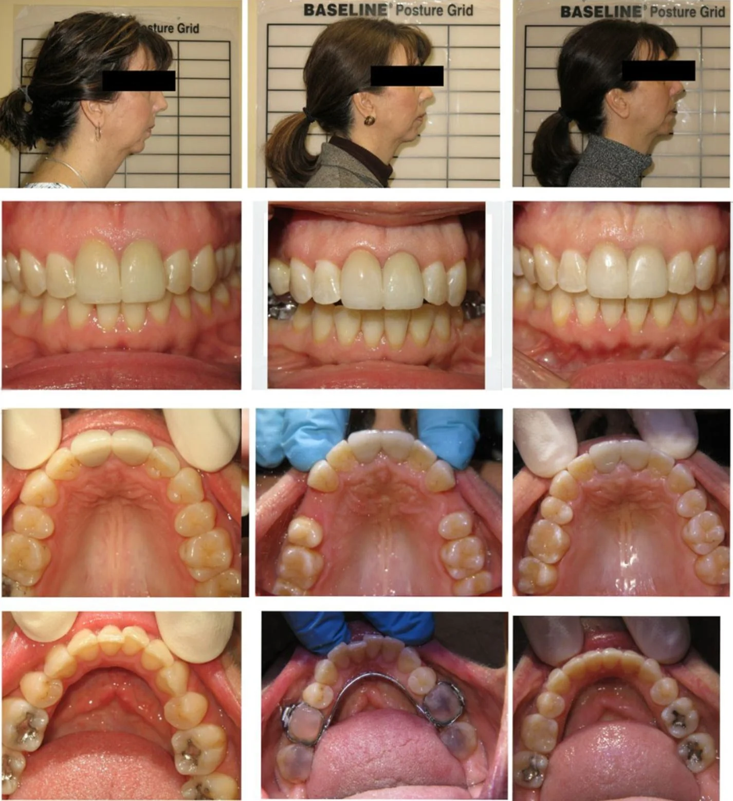 functional-orthodontics-1.jpg