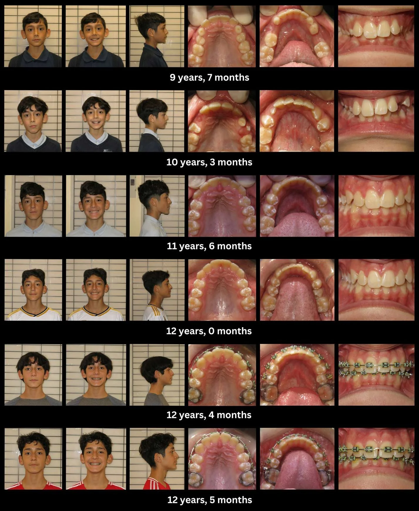 functional-orthodontics-5.jpg