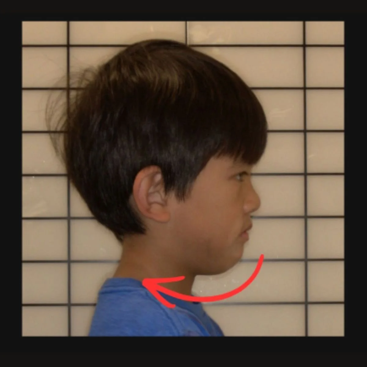  Expander 