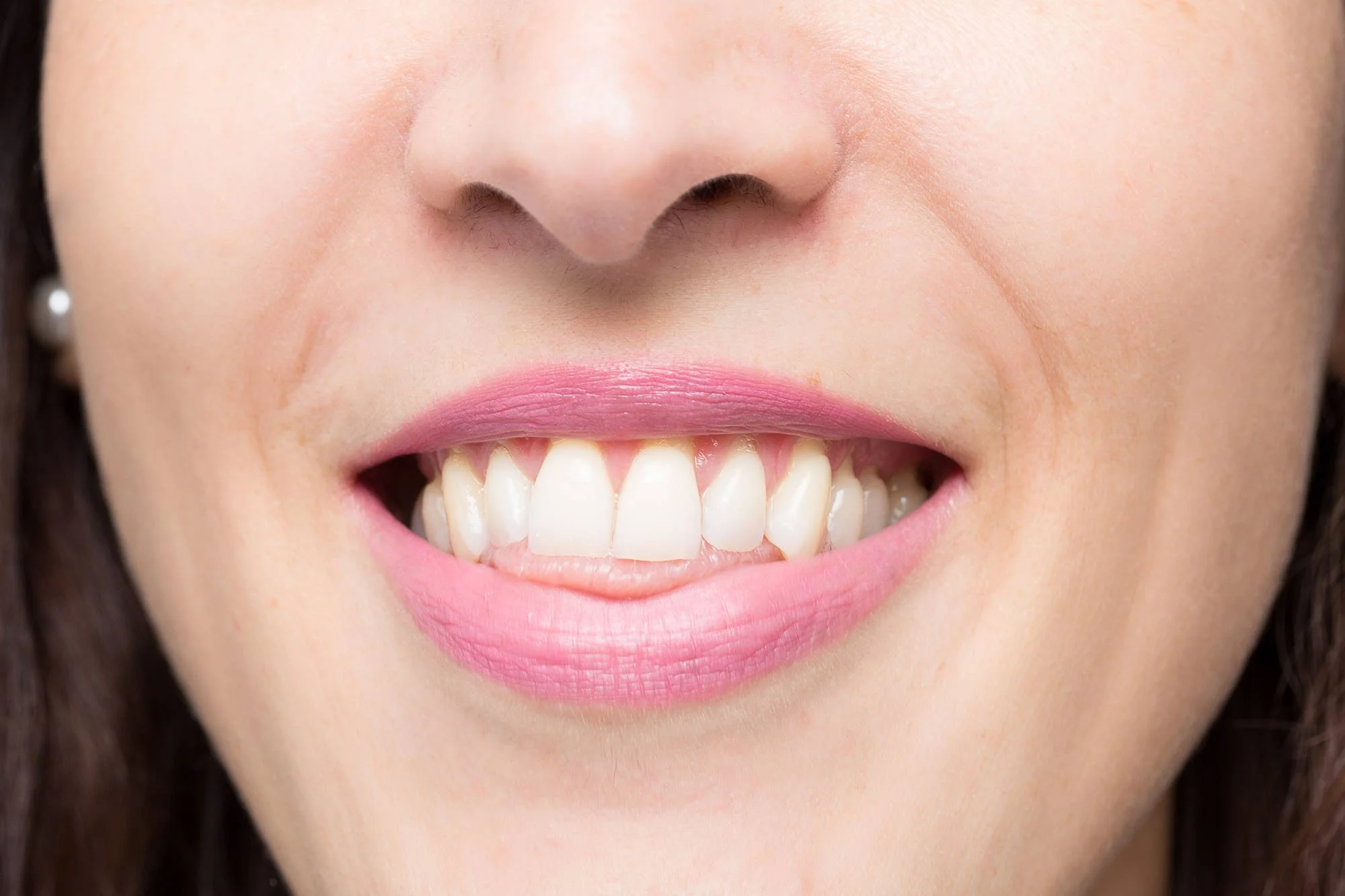 Woman face with tongue thrust