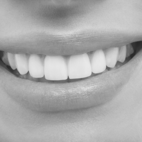 Close-up of a person smiling showing their upper teeth and lips in black and white.