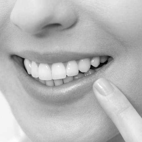Close-up of a person's smile showing teeth, with their finger touching their lower lip.