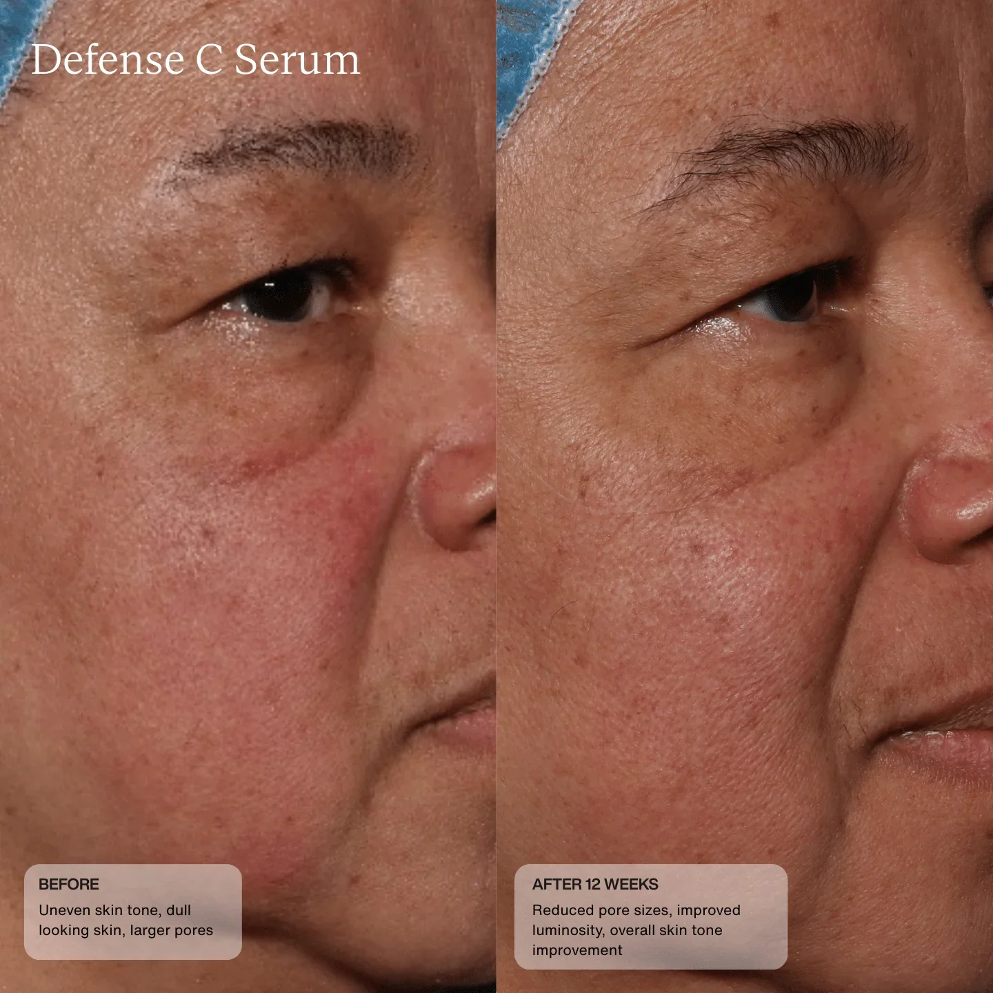 defense-c-serum-8978086.webp