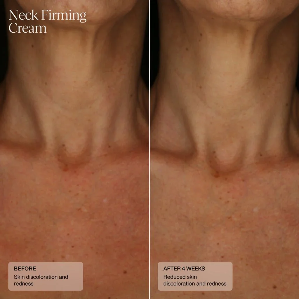 neck-firming-cream-305334.webp