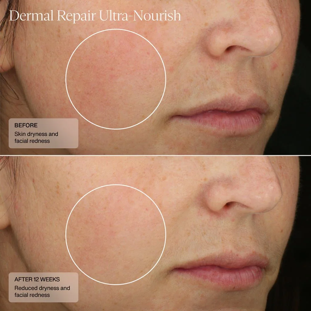 dermal-repair-ultra-nourish-435340.webp