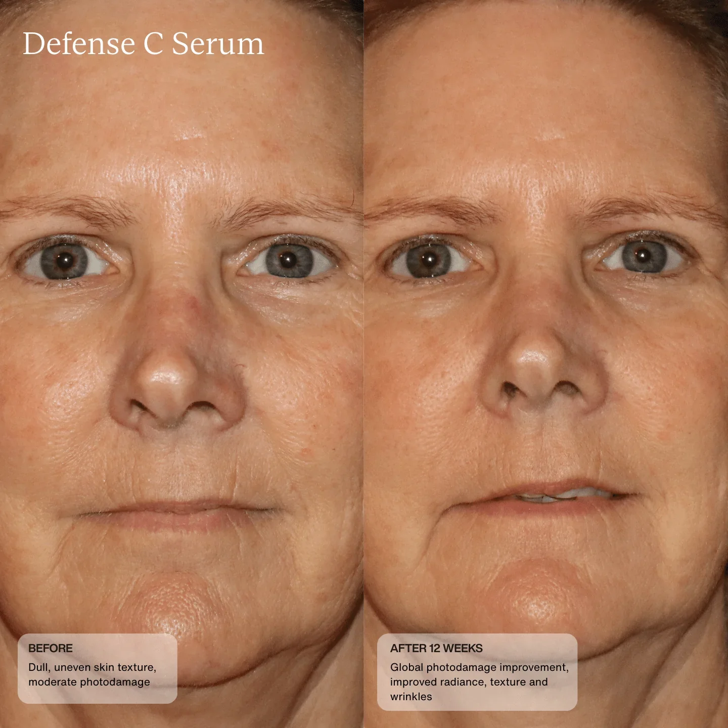 defense-c-serum-2108082.webp