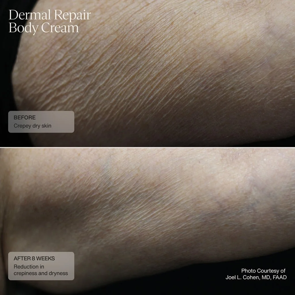 dermal-repair-body-cream-267064.jpg