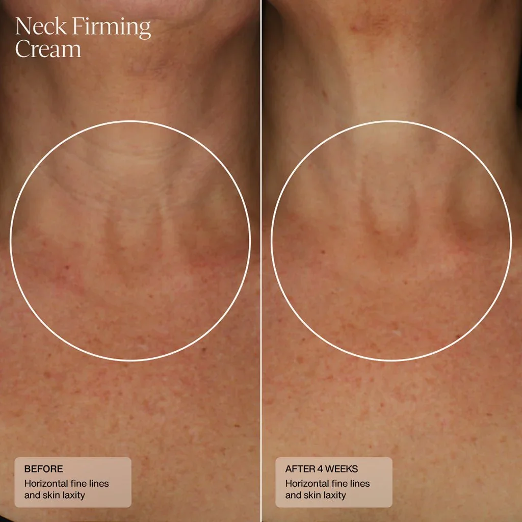neck-firming-cream-955711.webp