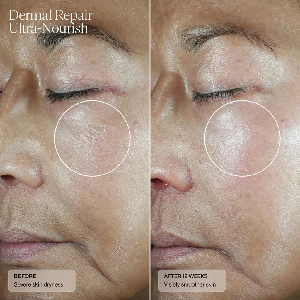 dermal-repair-ultra-nourish-677314.webp