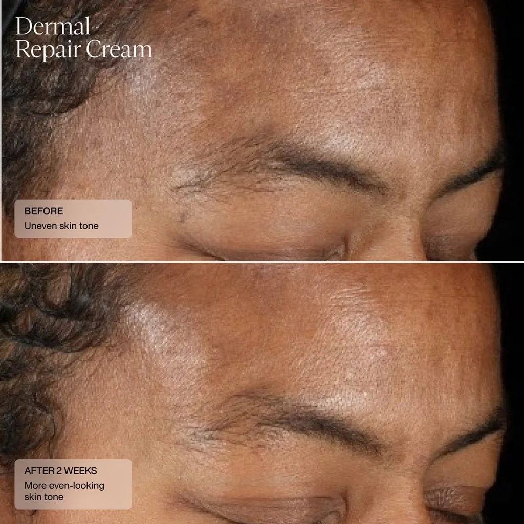 dermal-repair-cream-838713.jpg