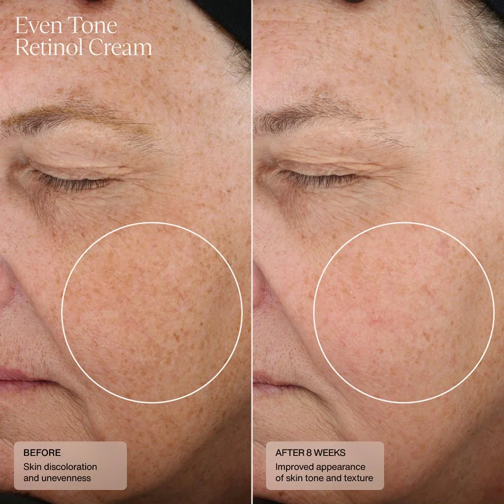 even-tone-retinol-cream-154245.webp