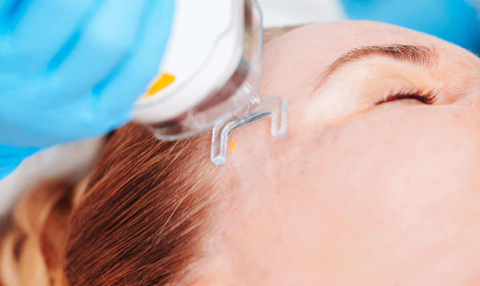 Medspa in Bolivar, MO, 65613 | Laser Resurfacing Near Me