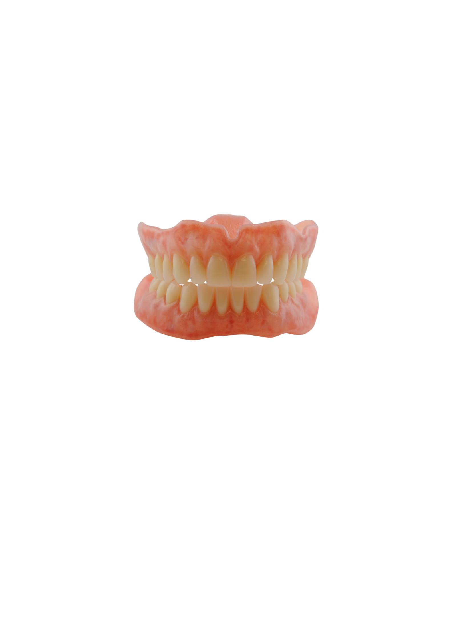 Complete Dentures