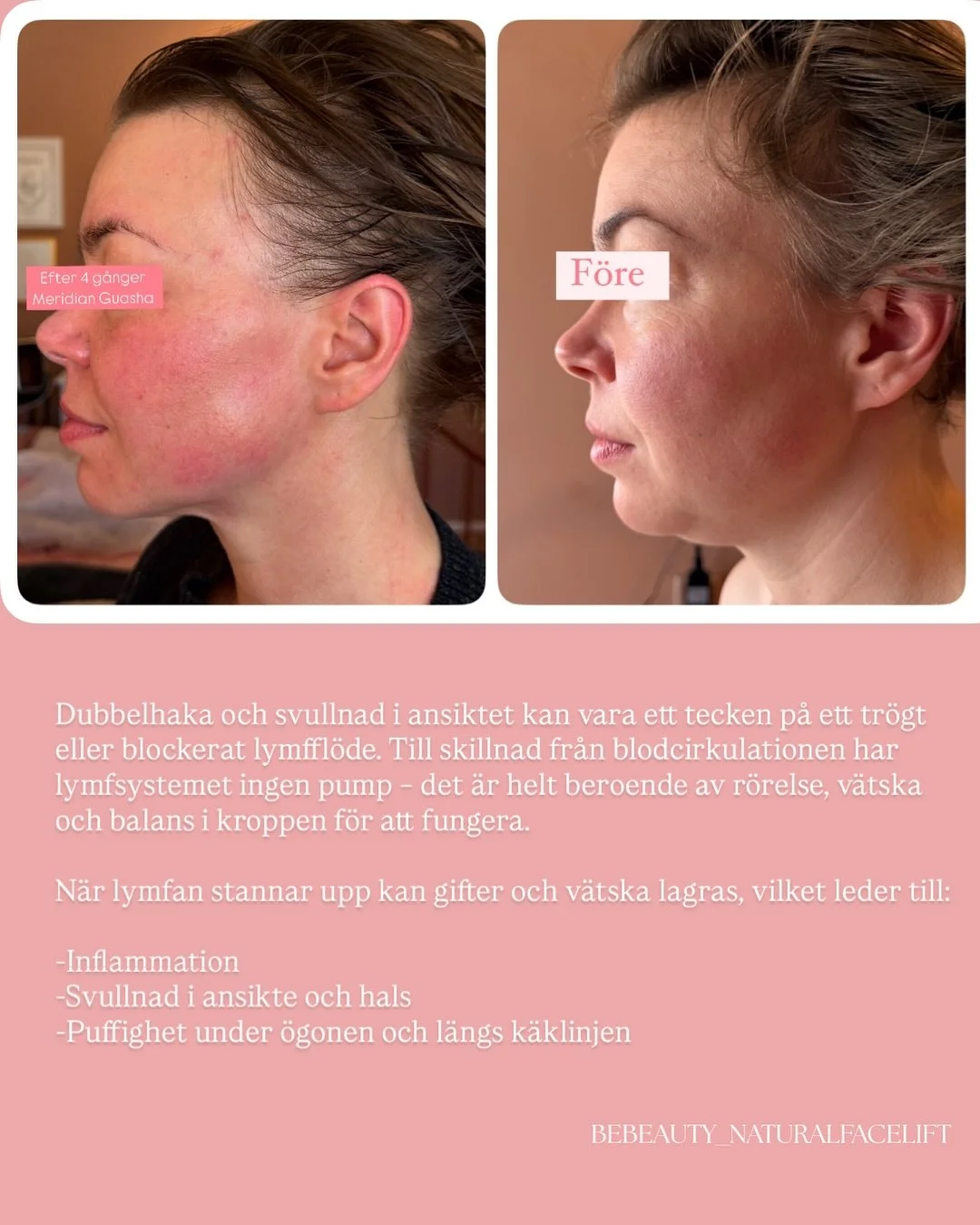 Det lymfatiska systemet &auml;r kroppens tystaste helare ✨
Det som aldrig kr&auml;ver uppm&auml;rksamhet men b&auml;r den tyngsta arbetsb&ouml;rdan. 
Det &auml;r systemet som transporterar bort cellul&auml;rt avfall, reglerar v&auml;tskebalansen, fil