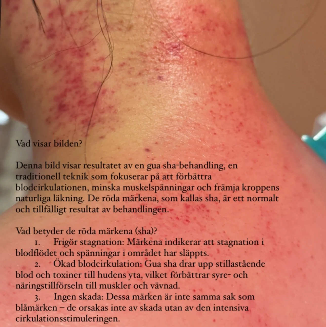 &Auml;r det inte dags att komma i r&ouml;relse igen &ndash; att &aring;ter f&aring; fl&ouml;de i din stillast&aring;ende Chi-energi (livsenergi)?

Denna tusen&aring;riga Gua Sha-teknik &auml;r inte bara effektiv f&ouml;r att arbeta med bindv&auml;v o