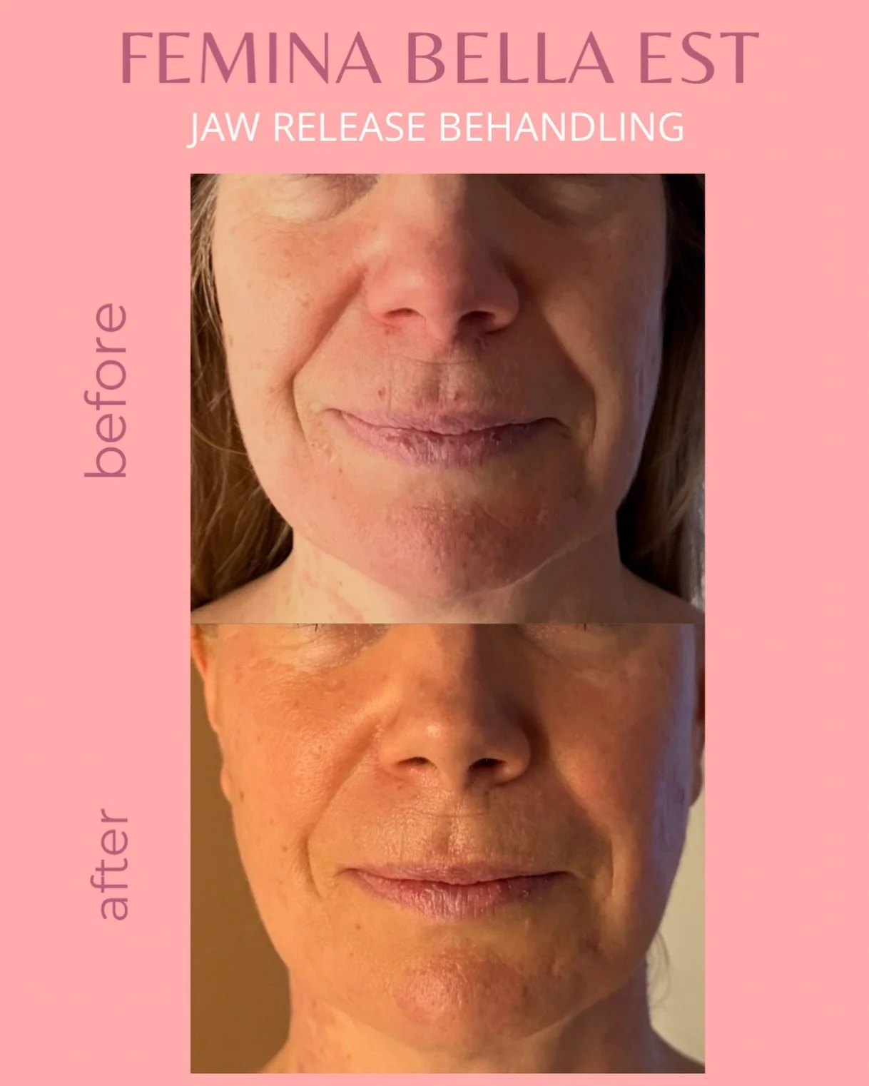 FEMINA BELLA EST&reg; JAW RELEASE

Mer &auml;n en estetisk behandling &ndash; fokus p&aring; funktion, cirkulation och balans.

M&aring;nga m&auml;nniskor b&auml;r p&aring; l&aring;ngvariga sp&auml;nningar i k&auml;kar, ansikte och nacke till f&ouml;