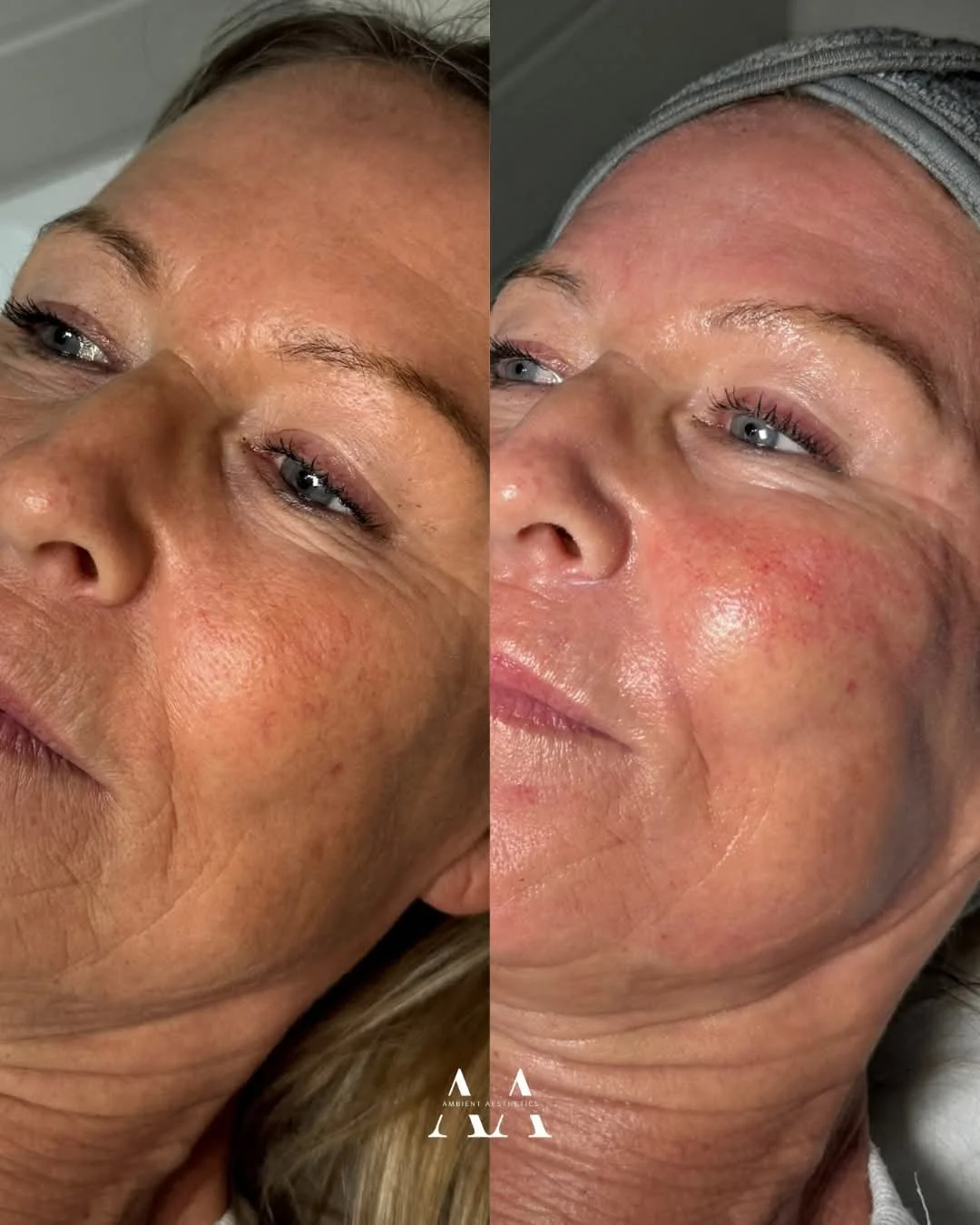 Glass Skin Facial.jpg