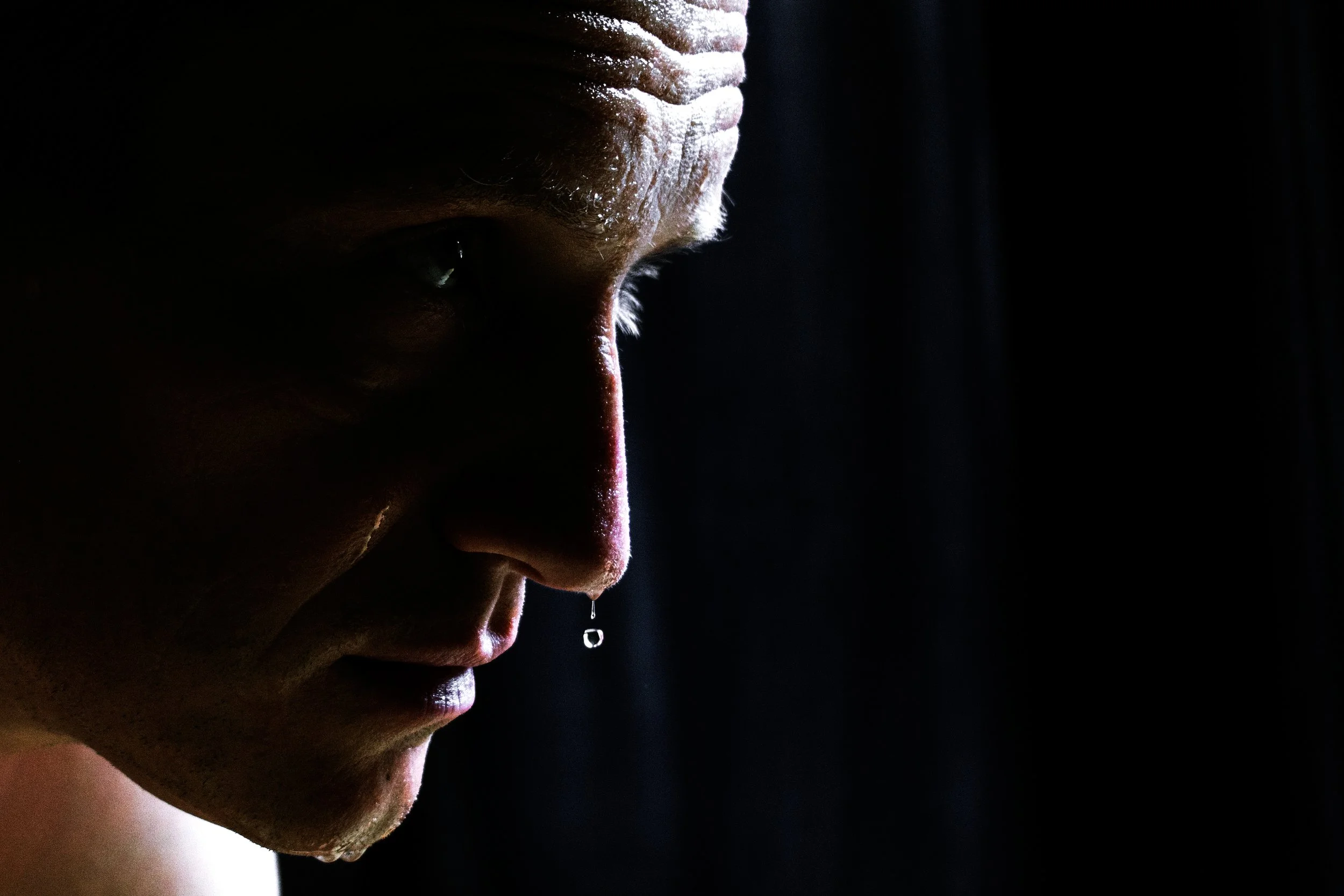 Pre and Post OP / Workout / Athletic IV