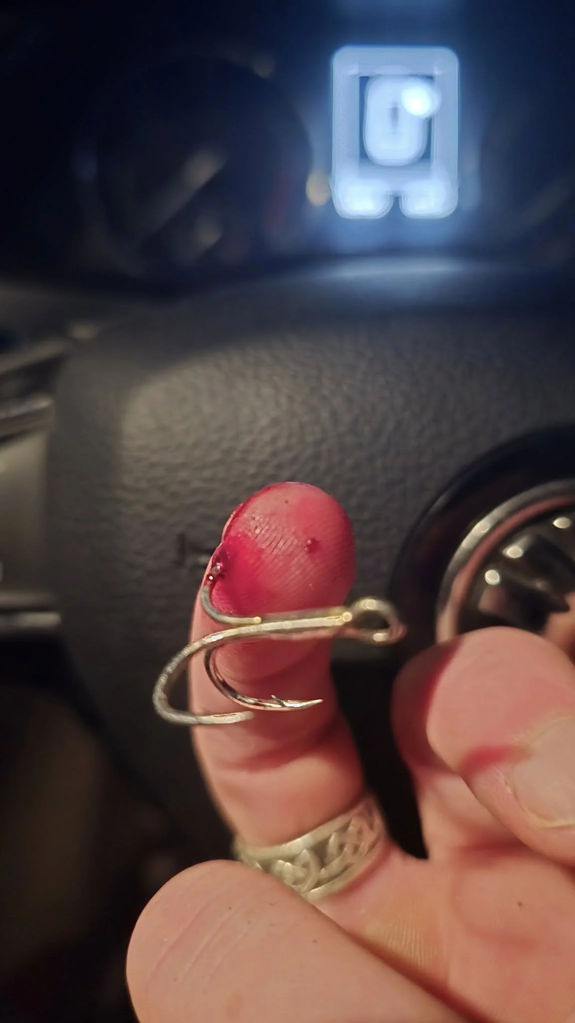 Hooked, Dropped, and Off to A&amp;E – A Session Gone Sideways