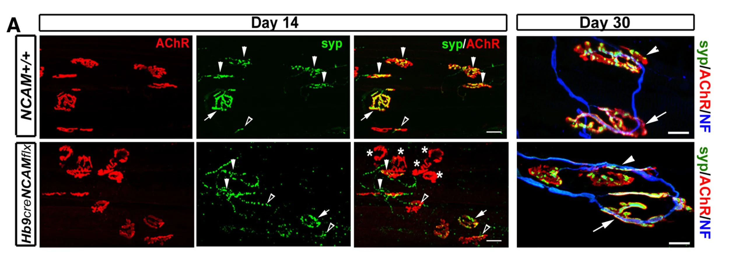 Presynaptic NCAM is required for motor neurons to functionally expand their peripheral field of innervation in partially denervated muscles